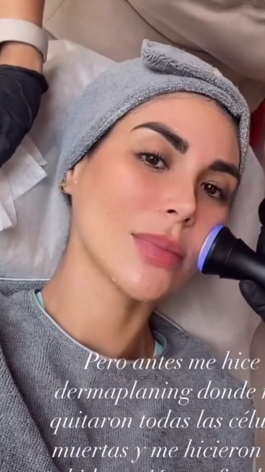 Historia de Instagram de Clienta de Botánica: Me hice dermaplaning: me quitaron todas las células muertas y me hicieron una hidratación.
